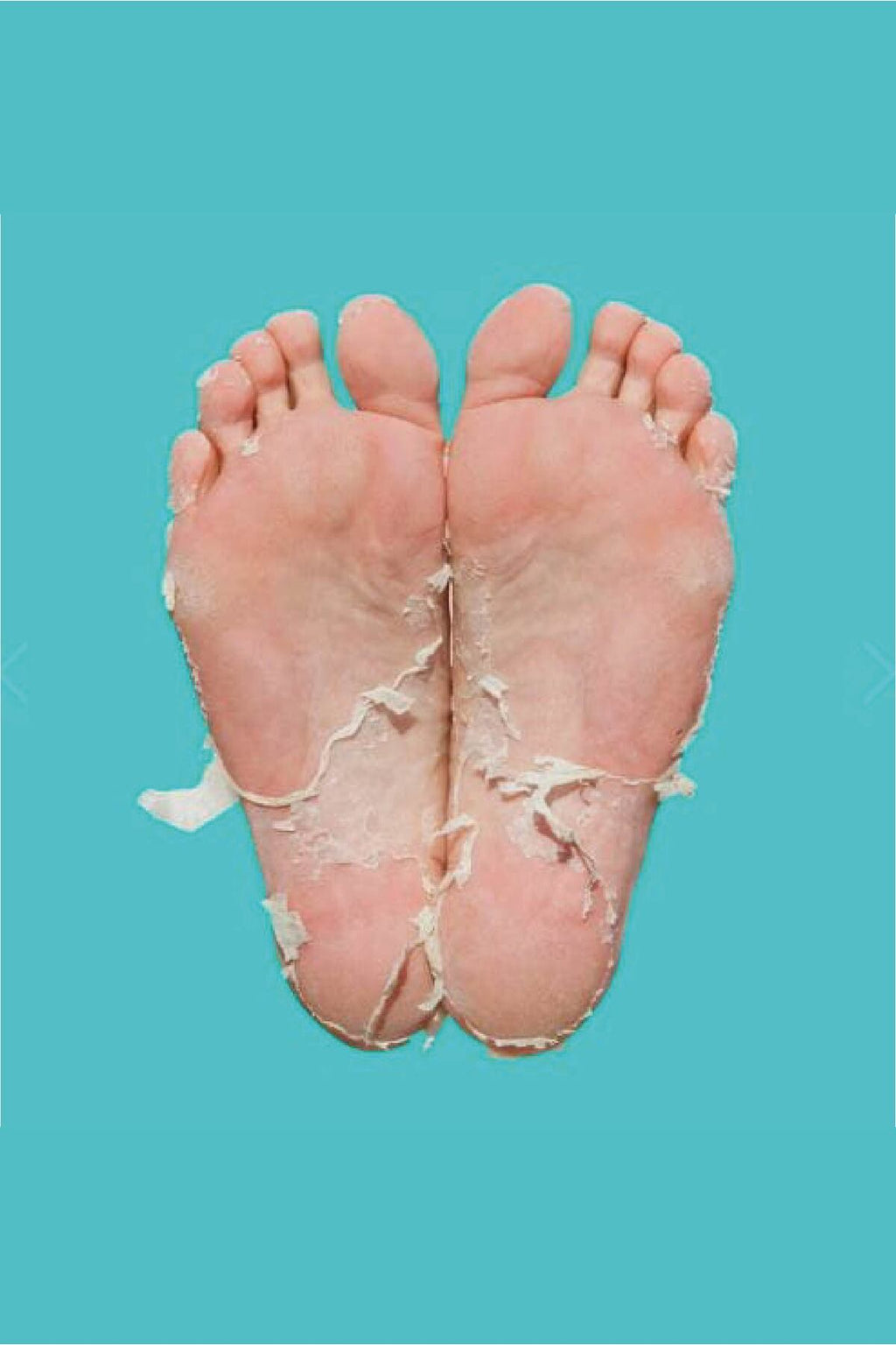 Peeling Etkili Yenileyici Ayak Maskesi