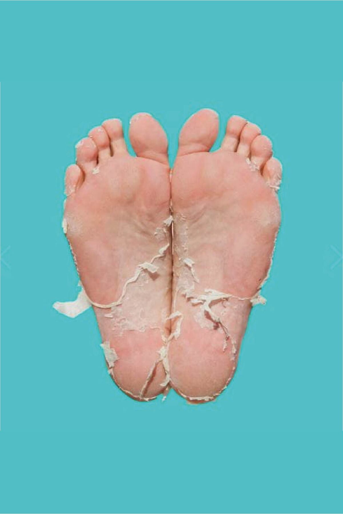 Peeling Etkili Yenileyici Ayak Maskesi